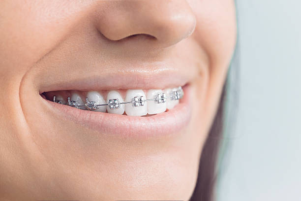 Best Veneers and Lumineers  in Campton Hls, IL